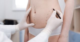 Esqueca-as-grandes-cicatrizes-da-abdominoplastia-com-a-tecnica-Mila-1